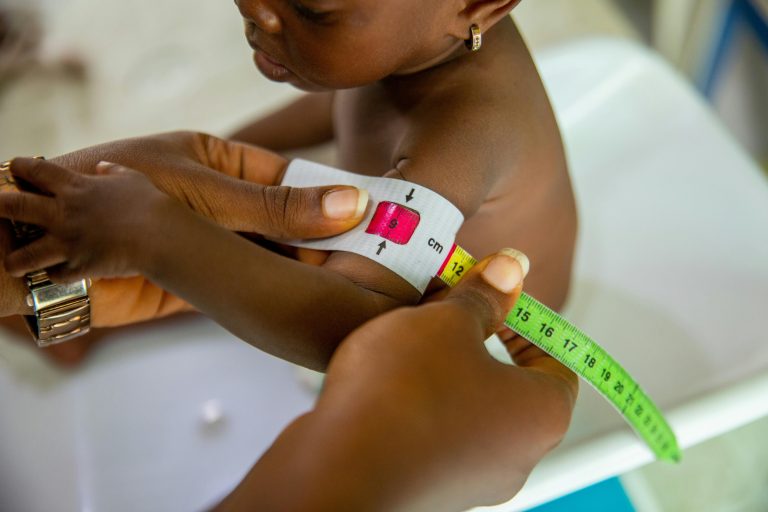 A Person Using a MUAC Tape on a Child